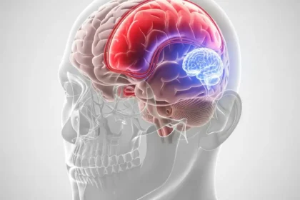 L’Hématome Sous-Dural : Comprendre, Prévenir et Agir