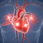 Comprendre l’Insuffisance Cardiaque : Un Guide Complet